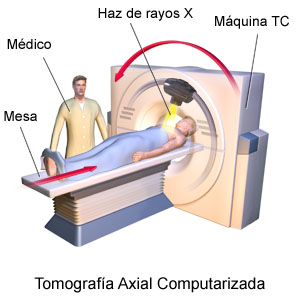 tomografía axial computarizada