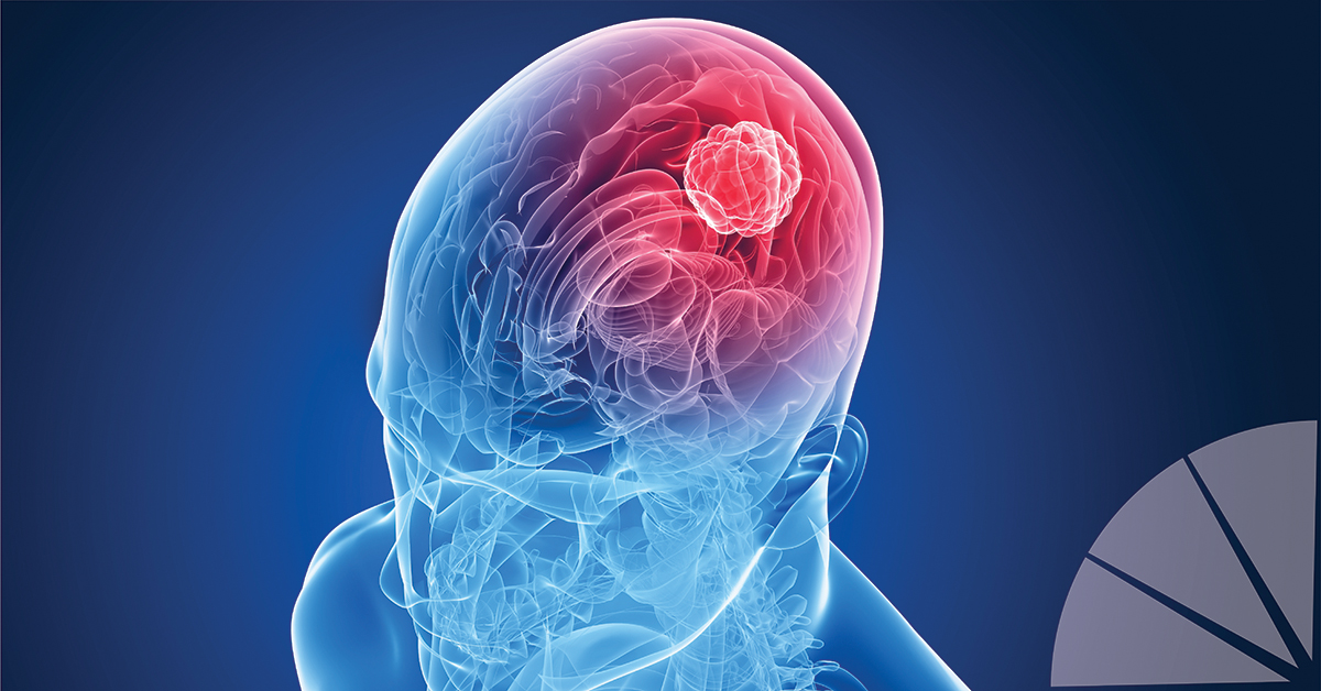 Para El Cerebro No Dormir Es Como Emborracharse