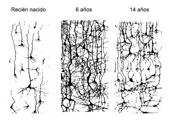 La Poda Neuronal: Qué Es Y Para Qué Nos Sirve - Gamma Knife